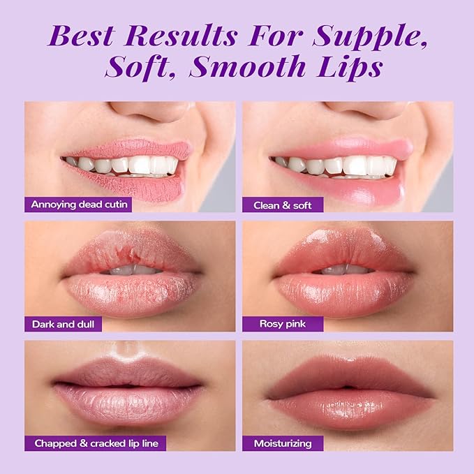 ANAI RUI Lip Therapy Set - Scrub & Mask, Overnight Hydrating Moisturizer With Exfoliator and Sleeping Mask for Plumping - Gift Kit for Dry, Chapped, Dark Lips, Grape