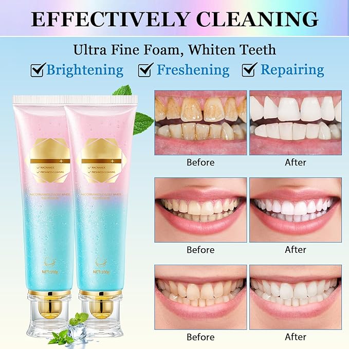 2Pcs Niacinamide Whitening Toothpaste Acssart Radiant White Toothpaste,Niacinamide Intensive Whitening Toothpastes,Nicotinamide Radiant Whiten Toothpastes