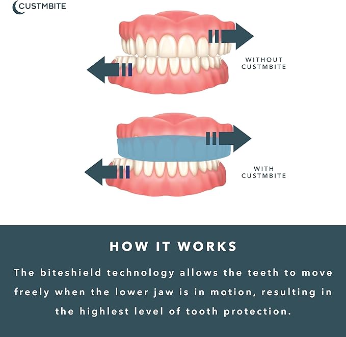 CUSTMBITE Premium Pro+ Night Guard with BiteGuard Technology, 2 Pack with Mouth Guard Case, USA Made, Mouth Guard for Grinding Teeth at Night, Bruxism NightGuard