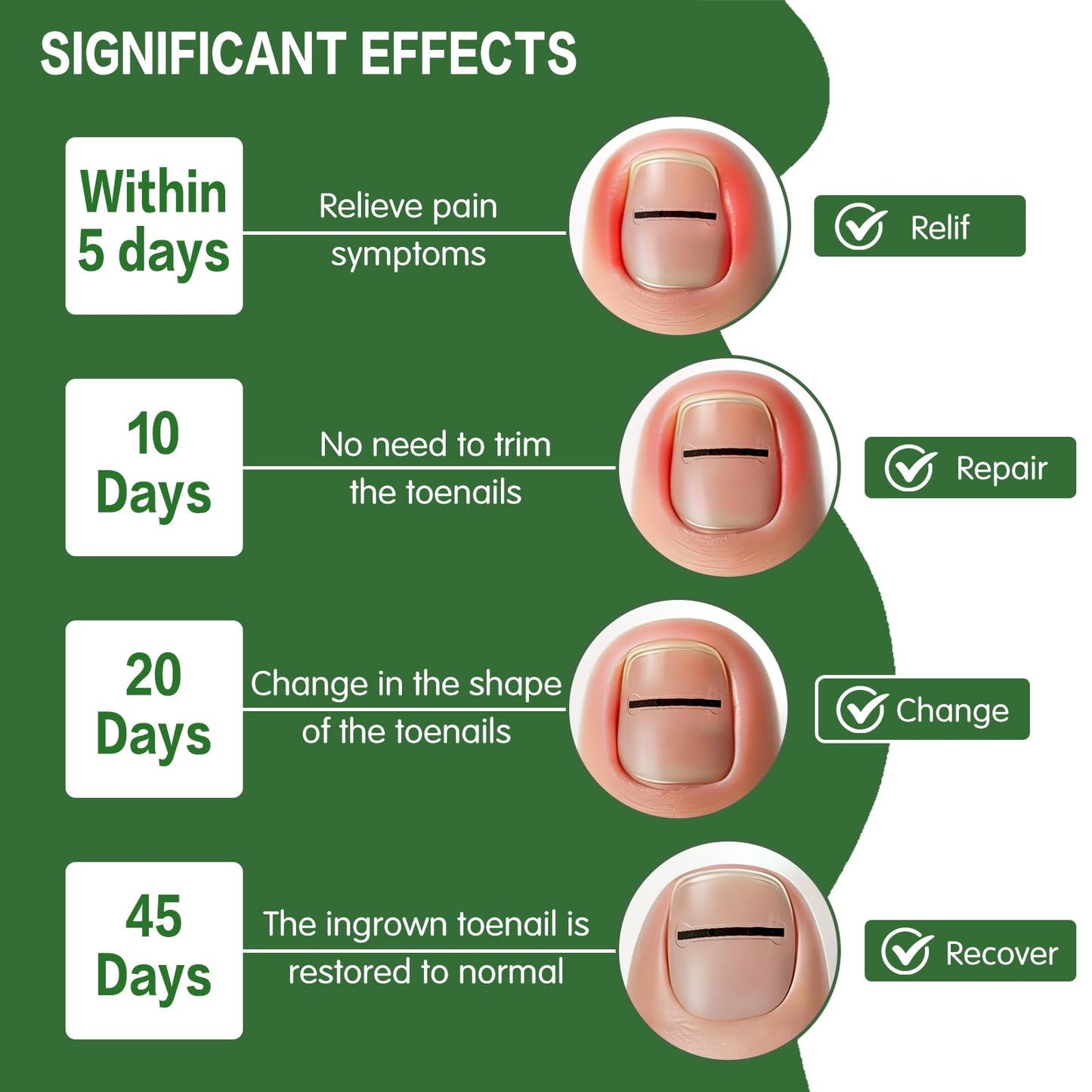 Titanium Alloy Ingrown Toenail Corrector, Professional Home Care In grown Removal Kit for Curved Repair and Ingrown Toenail Corrector,10Pcs Toe Nail Correction Strips,Stop Nail Biting Quick Relief