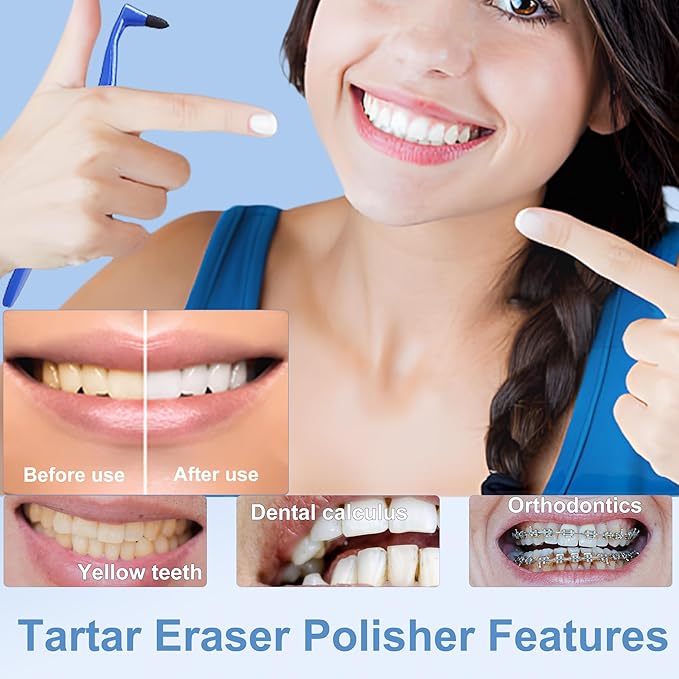 3Pcs Teeth Stain Remover,Tooth Stain Eraser,Tartar Eraser Polisher,Dental Plaque Tool,Eraser for Coffee Stain Teeth Whitening Cleaning Polishing Kit (white)