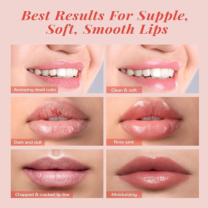 Stocking Stuffers Lip Mask Set, Lip Scrub & Lip Butter, Overnight Lip Treatment Set Enriched With Skin Softening Ceramide & Watermelon and Hydrating Shea Butter, For A Softer & Smoother Pout