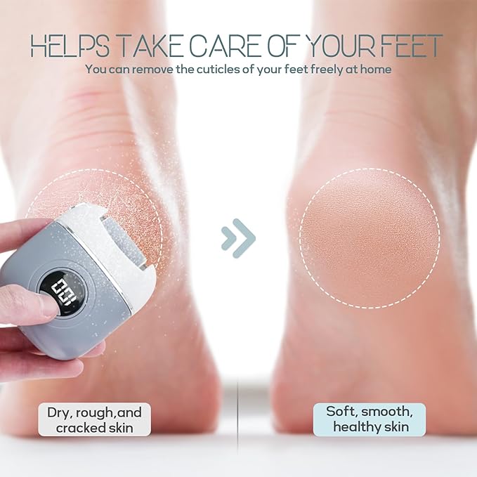 Automatic Callus Remover for Feet, Rechargeable Pedicure Tools for Feet, Electric Foot Callus Remover with 3 Roller Heads 2 Speed, Waterproof Foot File Perfect for Dead Hard Cracked Dry Skin