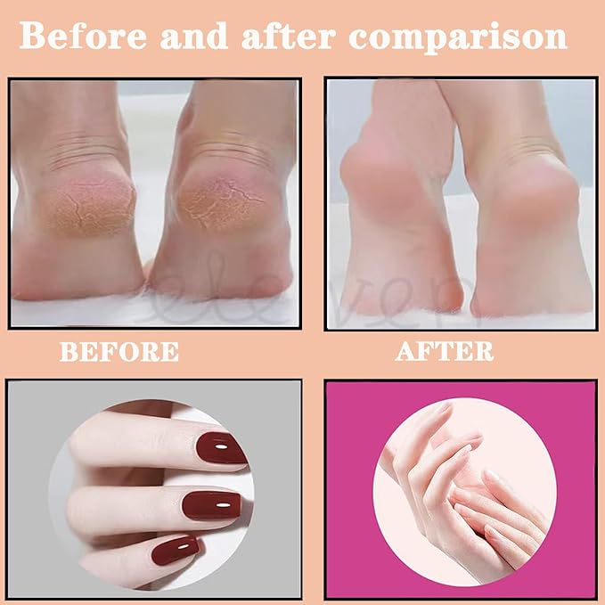 Darmave Cordless Electric Foot Callus Remover, 9 Speed Adjustable Speed Rechargeable Foot Sander Pedicure Tools for Feet Dead Skin with 80 pcs Sandpaper Disk and 20pcs Nail Buffer Sanding Rings