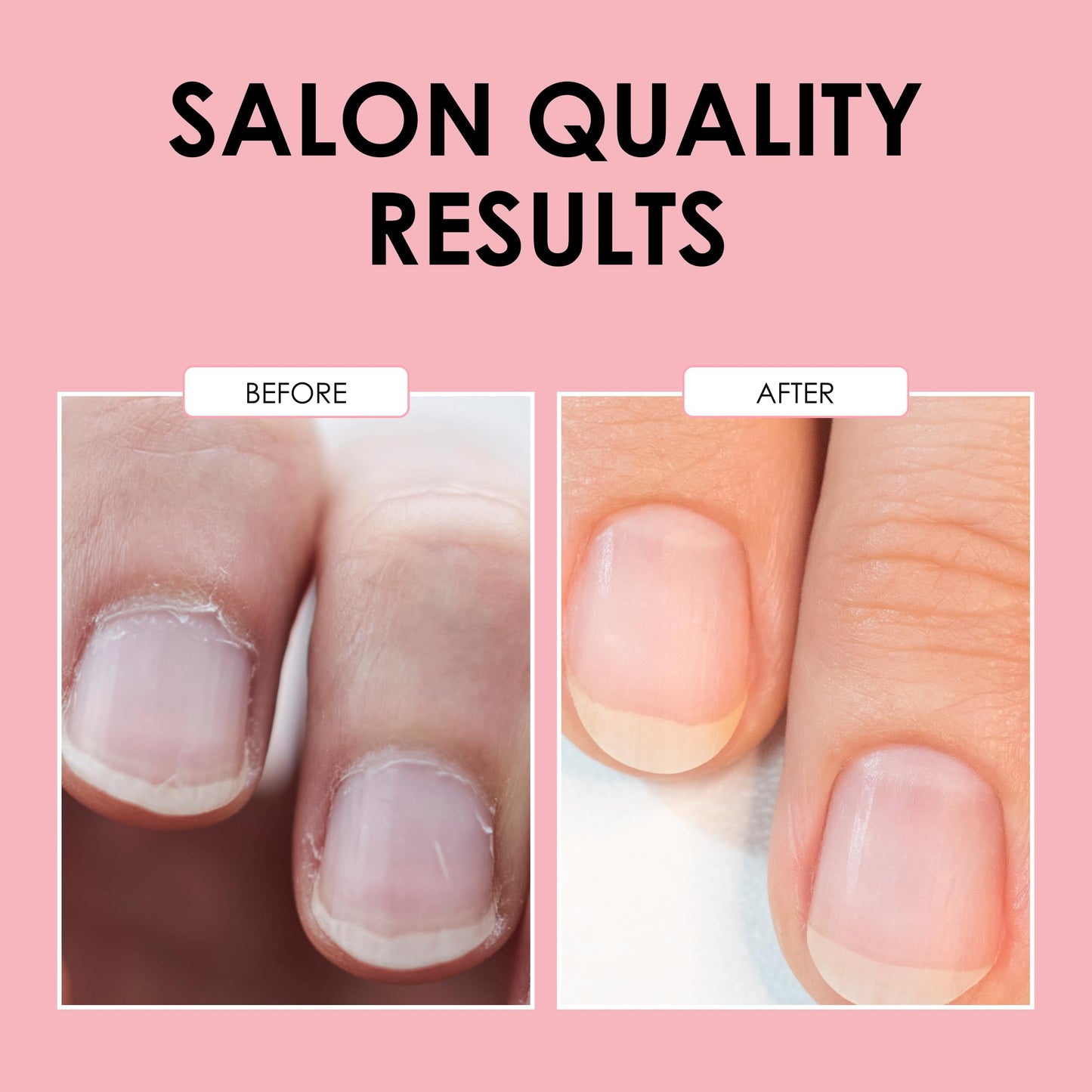 JAPONESQUE Cuticle Pusher and Trimmer Tool for Nails, Stainless Steel Cuticle Remover for Manicure and Pedicure, Dual End Nail Cuticle Pusher and Cutter for Cleaning, Shaping and Removing Dead Skin