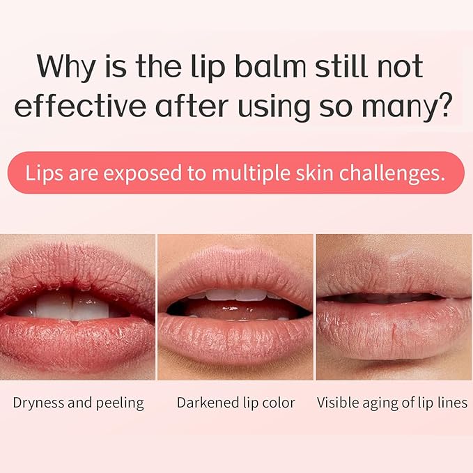 Lip Sleeping Mask - Overnight Repair for Dry, Chapped Lips with Hyaluronic Acid, Vegan & Cruelty-Free, Hydrating, Exfoliating, Non-Sticky, Long-Lasting Moisture