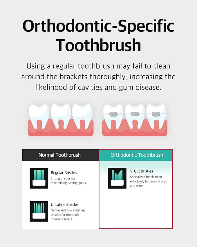 V-Cut Orthodontic Toothbrush (Mint) x 6Units – Medium Bristles, Ergonomic, Travel-Friendly Manual Toothbrush for Adults