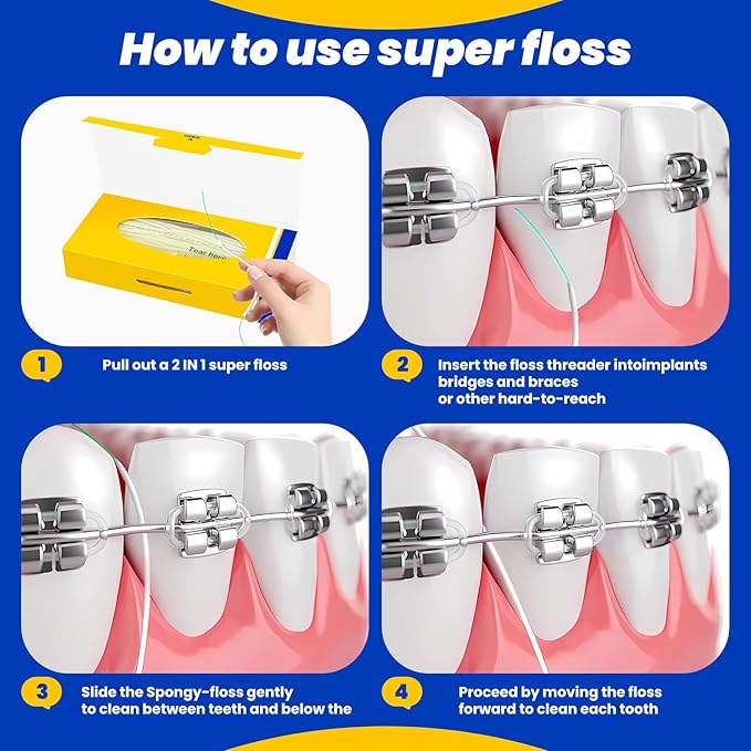 Dental Floss for Braces,Pre-Cut Strands Floss,Threaders for Bridges,Threaded Floss for Braces & Bridges,50 Counts