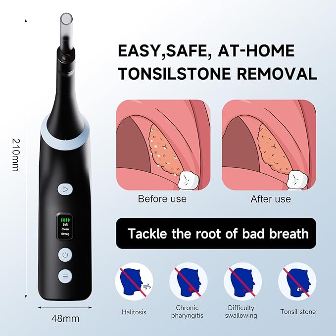 Electronic Tonsil Stone Remover with Camera, Tonsil Stone Removal Kit, 3 Suction Levels, Tonsil Stone Vacuum, Oral Care for Mouth Health, USB Rechargeable (Black)