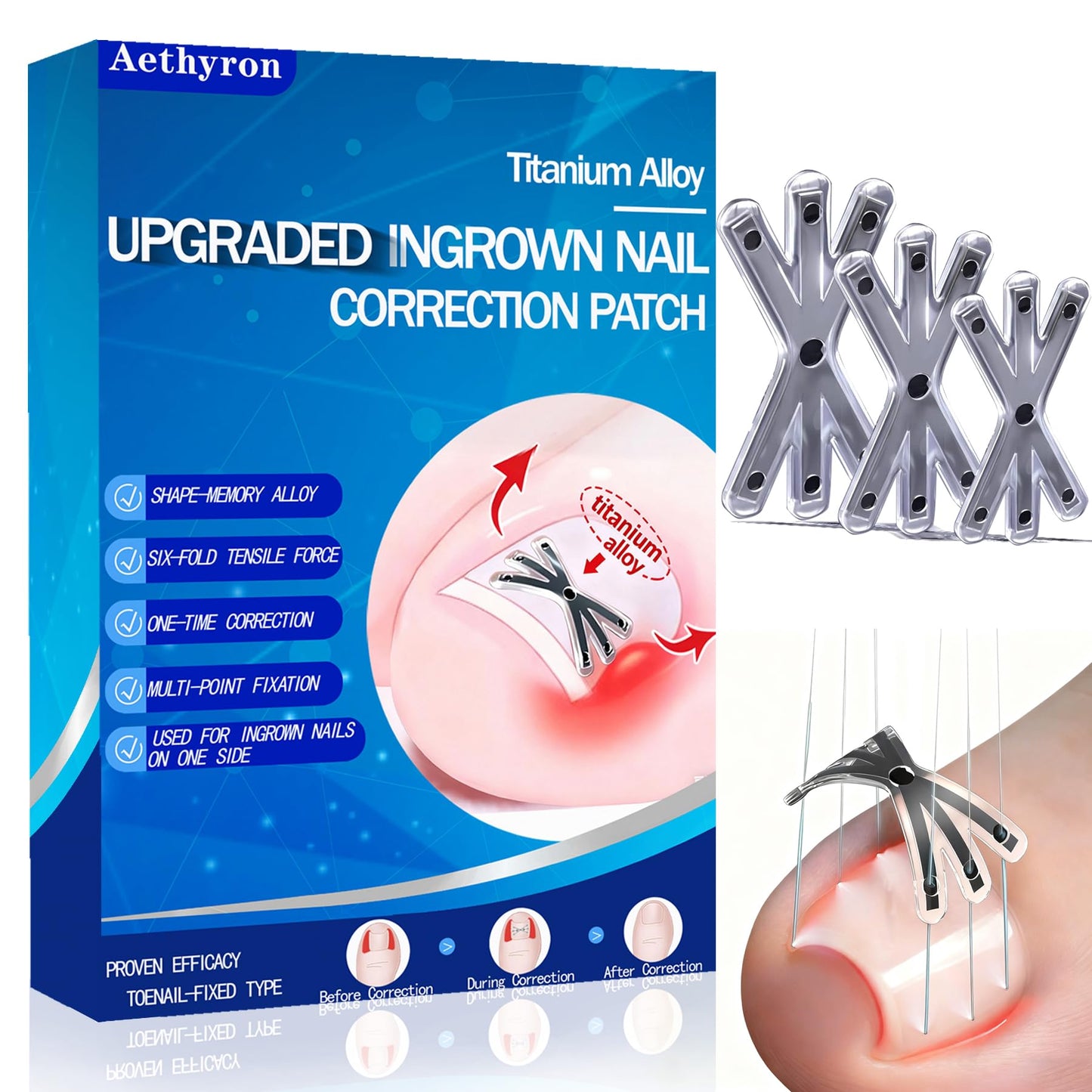 Ingrown Toenail Treatment with Upgraded 6-Angle Shape,Titanium Alloy Ingrown Toenail Corrector for Quick Relief,At-Home Ingrown Toenail Removal Kit for Toenail Curled Corrector,9Pcs