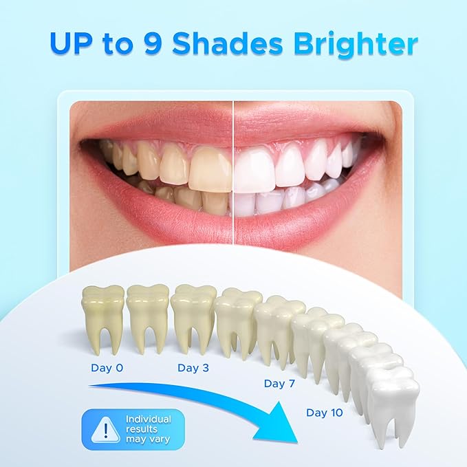 Luelli Teeth Whitening Pen, 20+ Uses - Travel Size Professional Tooth Whitener Serum, Extra Strength Organic Teeth Bleaching Gel for Sensitive Teeth, Instant Stain Removal, Simply White Smile, 4 Count