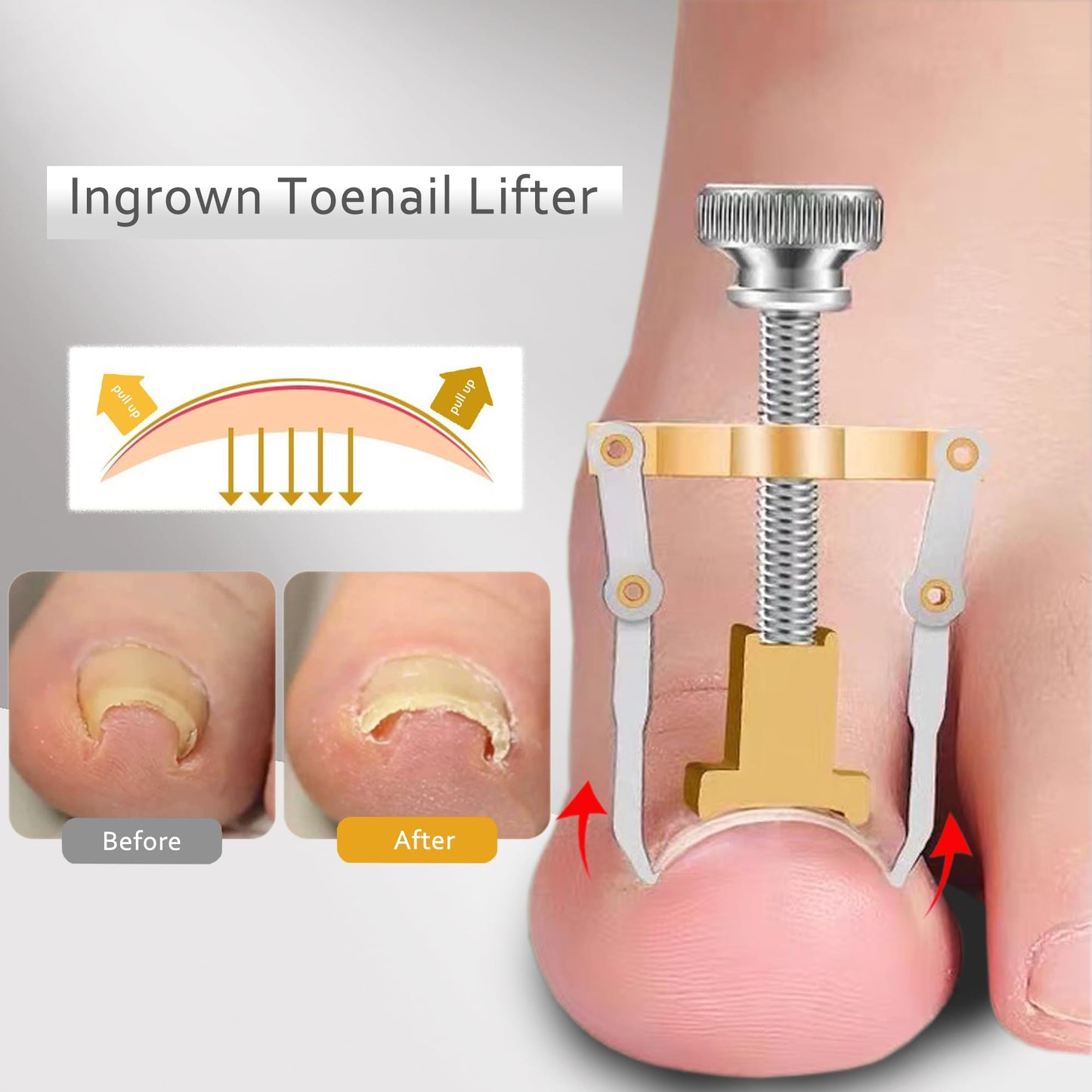 Toenail Clipper for Thick Nails Seniors Ingrown Toe Nail Pedicure Knife for Ingrown Nails Removal Kit Cutter Toenail