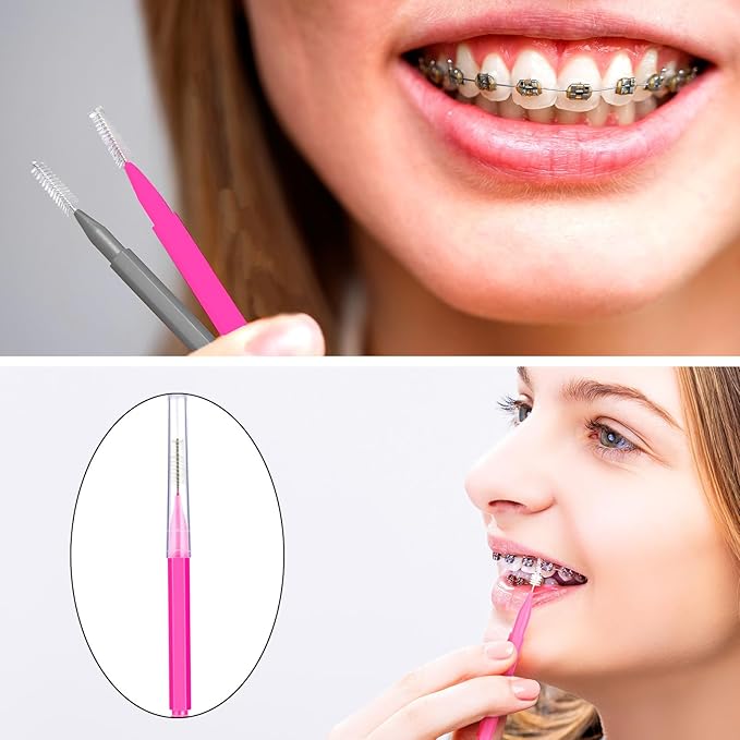 Patelai 100 Pieces Braces Brush for Cleaner Interdental Brush Toothpick Dental Tooth Flossing Head Oral Dental Hygiene Flosser Toothpick Cleaners Tooth Cleaning Tool(Pink, Grey,Ideal Size)