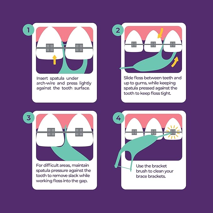 Platypus Orthodontic Flossers for Braces, 30 Count (Pack of 4), Ortho Picks for Adults & Kids, Fits Under Arch Wire, Non-Damaging, Encourage Flossing Habits
