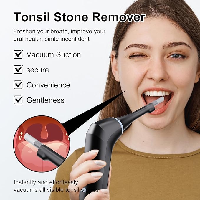 Electronic Tonsil Stone Remover with Camera, Tonsil Stone Removal Kit, 3 Suction Levels, Tonsil Stone Vacuum, Oral Care for Mouth Health, USB Rechargeable (Black)