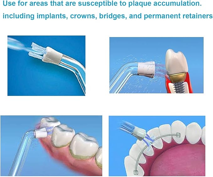 Plaque Removal Replacement Tips Compatible with Waterpik Water Flossers and Other Brand Oral Irrigators, Water Flosser Tip Replacement, Plaque Remove Brisles Tips(4-Pack)