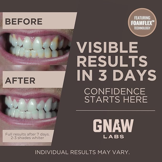 Teeth Whitening Strips for Men – 14 Treatments | Enamel-Safe Hydrogen Peroxide Formula Infused with Coconut Oil | FoamFlex™ Technology | No Sensitivity, Professional at-Home Whitening Kit