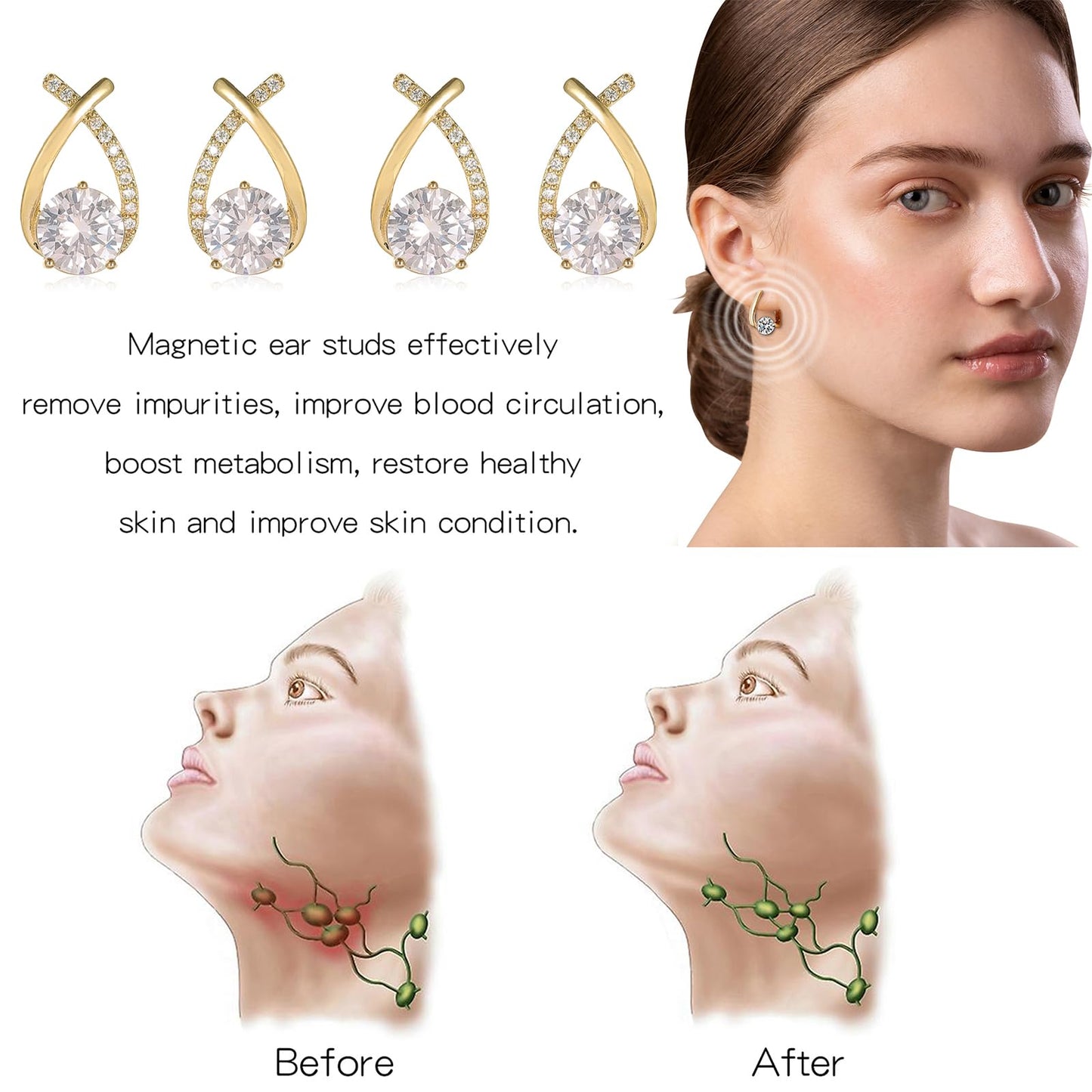 Lymphvity Earrings for Women Magnetotherapy Germanium Acupressure Earrings Lymph Drainage Therapy Earring Jewelry Set