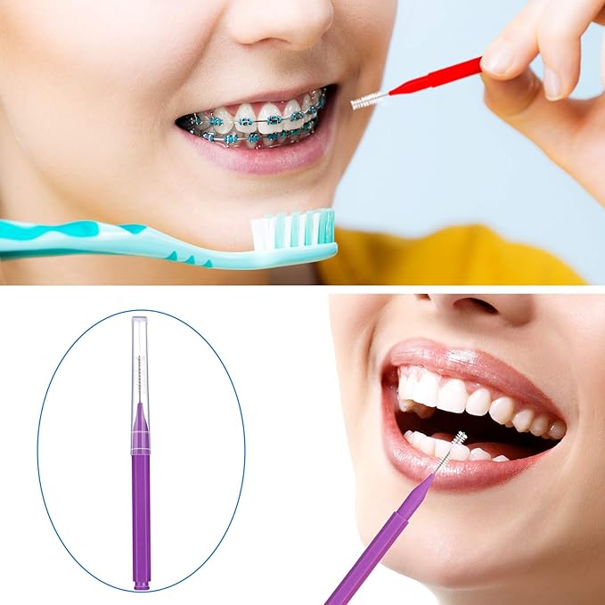 Patelai 100 Pieces Braces Brush for Cleaner Interdental Brush Toothpick Dental Tooth Flossing Head Oral Dental Hygiene Flosser Toothpick Cleaners Tooth Cleaning Tool(Classic Colors,Assorted Sizes)