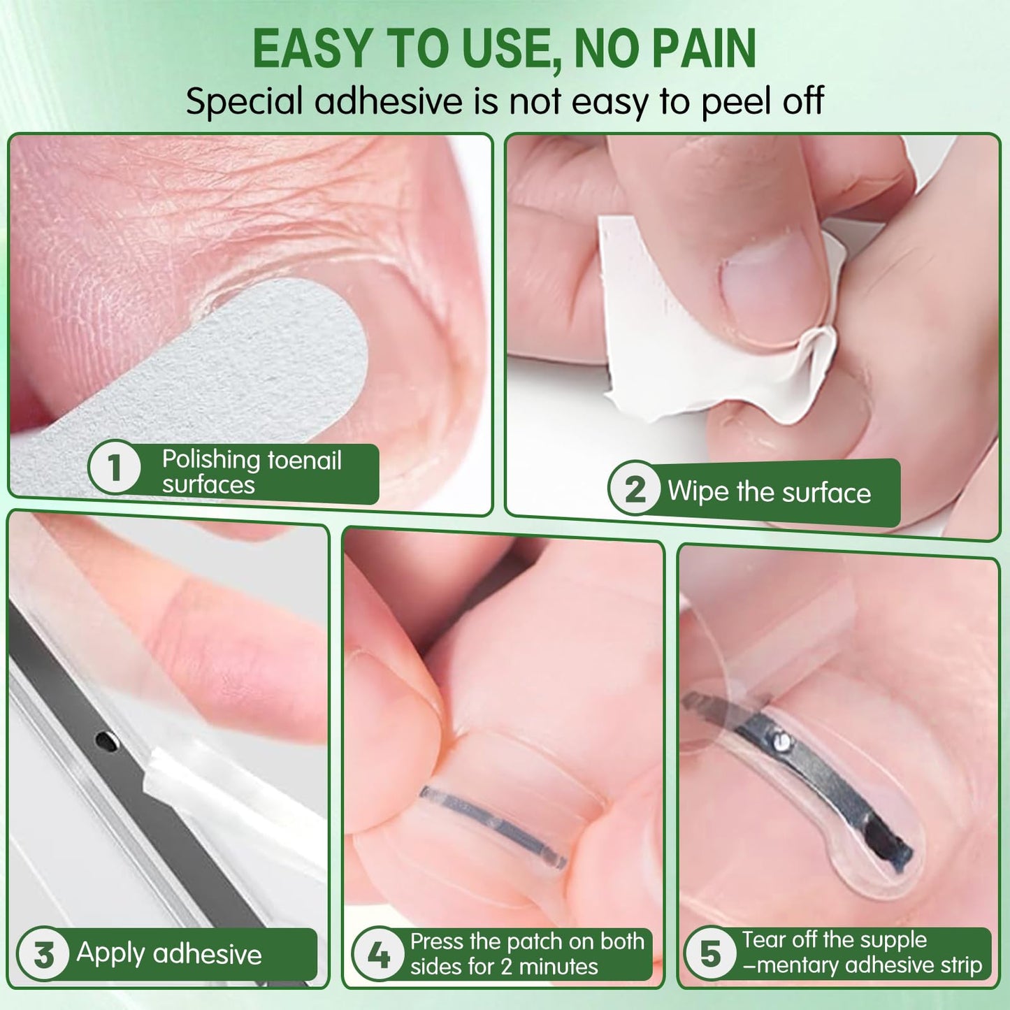 Titanium Alloy Ingrown Toenail Corrector, Professional Home Care In grown Removal Kit for Curved Repair and Ingrown Toenail Corrector,10Pcs Toe Nail Correction Strips,Stop Nail Biting Quick Relief