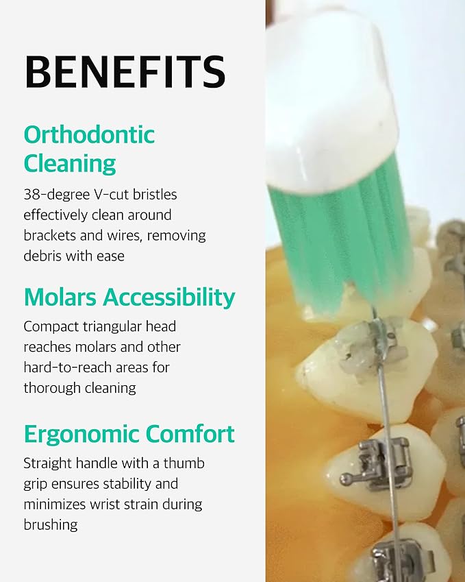 V-Cut Orthodontic Toothbrush (White) – Pack of 6, Medium Bristles, Ergonomic Manual Toothbrush for Adults