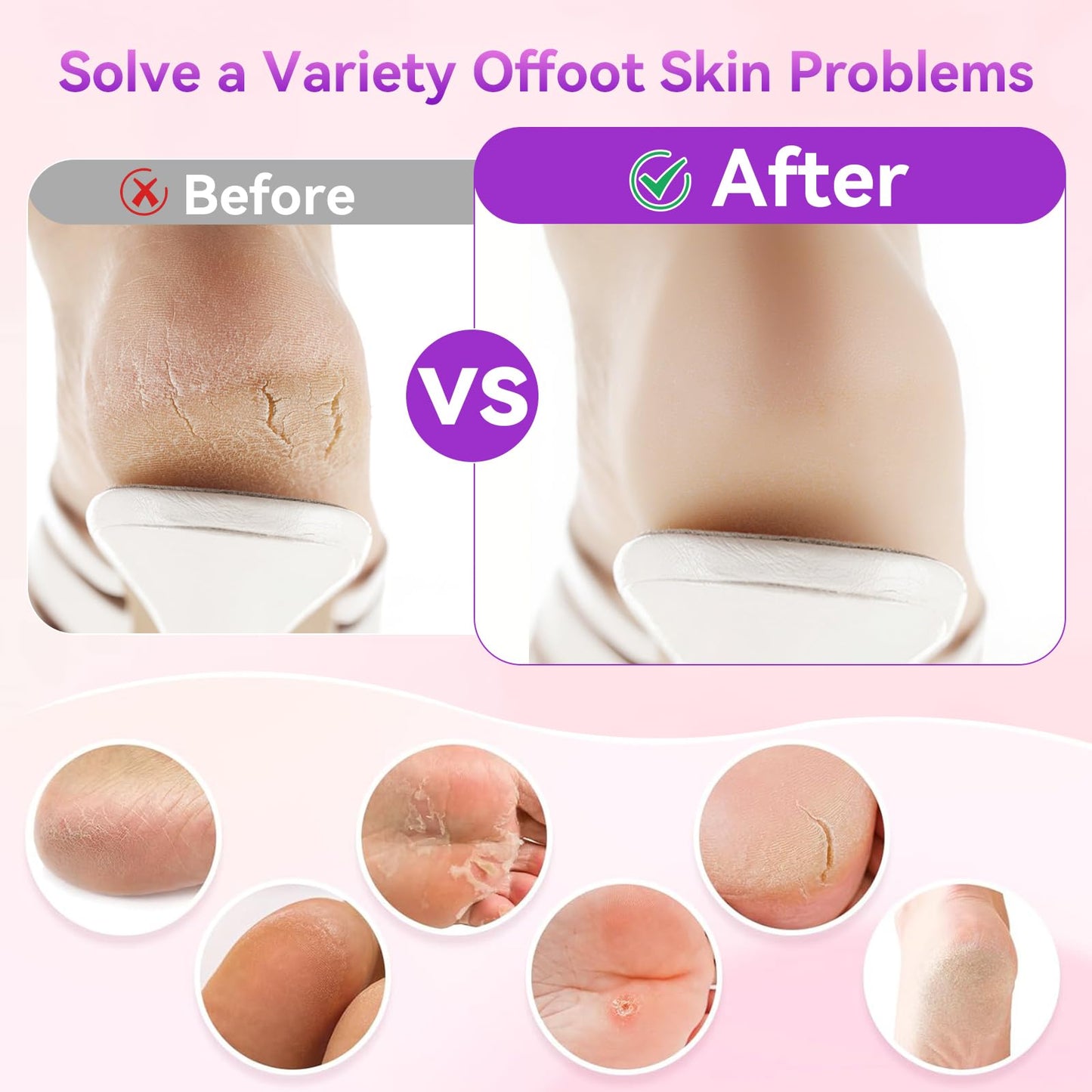 FAMILIFE Electric Foot File Callus Remover – Rechargeable Pedicure Tool with Display Screen, Replaceable Sandpaper Discs, Forward & Reverse Rotation, for Men and Women