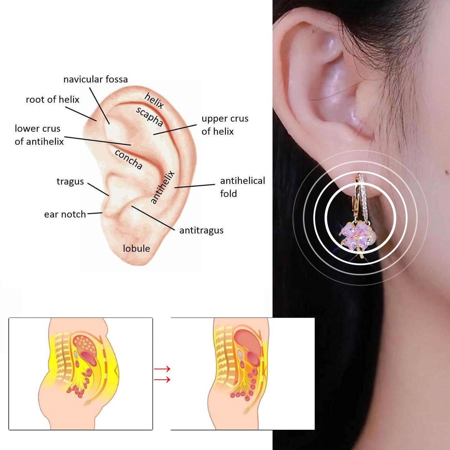 3 Pairs Lymphvity Therapy Germanium Earrings Lymphatic Drainage Earrings Acupuncture Earrings for Women Rhinestone Flower Hoop Earrings(A)