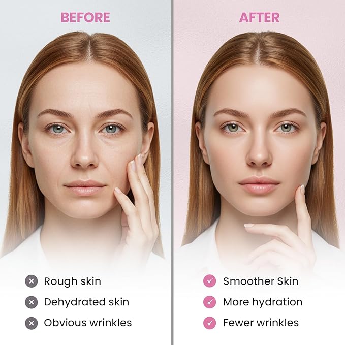 New Anti Facial Wrinkle Patches: Anti Wrinkle Patches Overnight - Smile Line Pathces - Facial Wrinkle Patche for Forehead, Smile Line, Under Eye ((1 Count (Pack of 144))