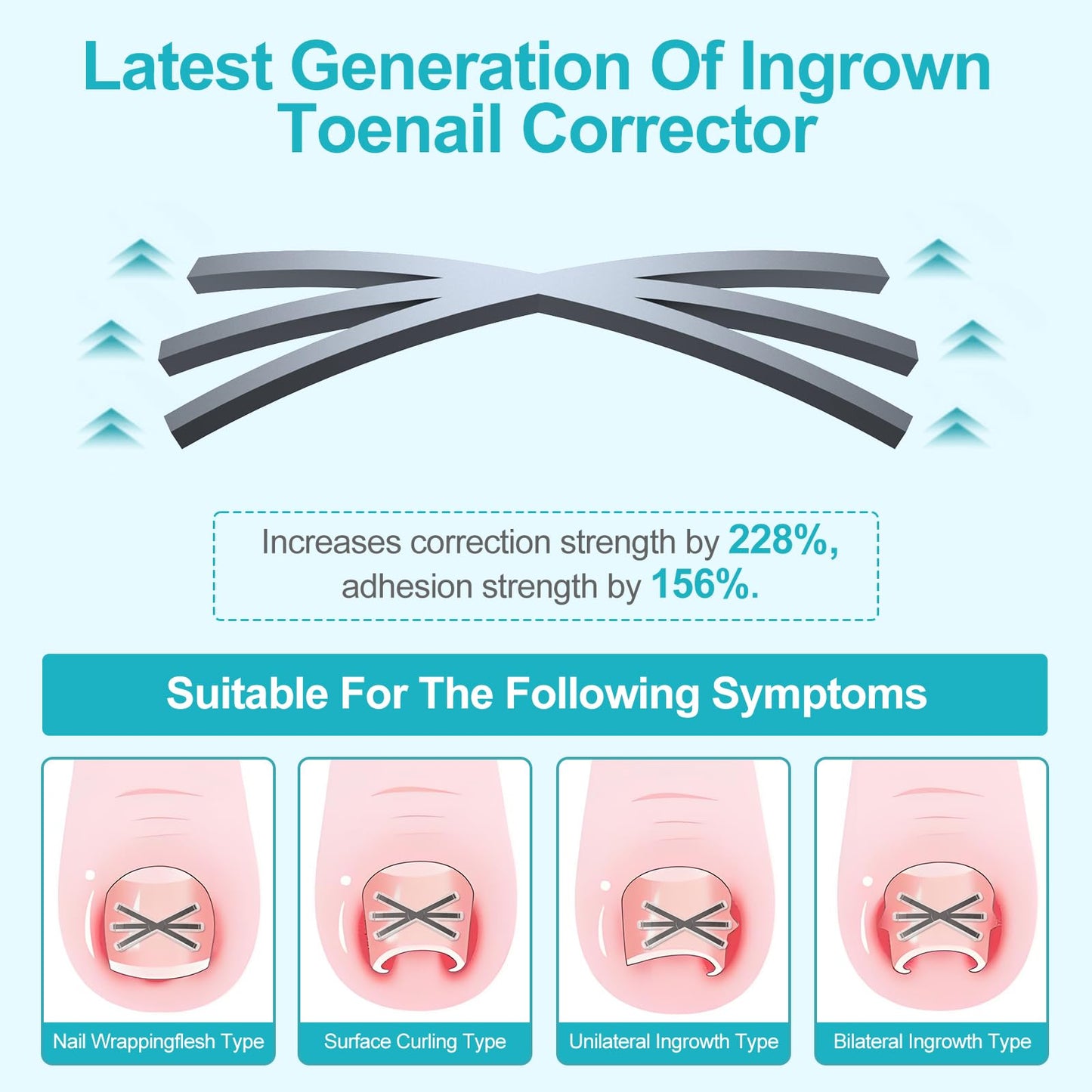 Ingrown Toenail Treatment Kit with Upgraded 6-Angle Shape,Titanium Alloy Ingrown Nail Corrector Tools with 4 Multi-Sizes,Ingrown Toe Nail Relief Remover Strips for Curved Toenail Quick Relief,8Pcs