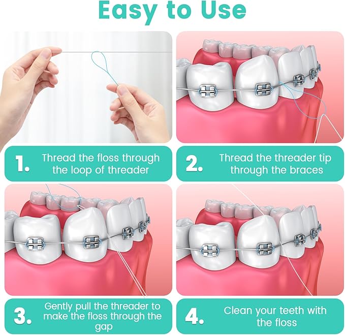 Floss Threaders, 400 Count Threaders for flossing, Dental Floss Threader for Braces, Bridges, Implants, Permanent Retainer (Pack of 4)