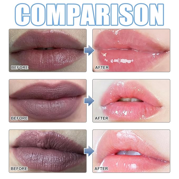 XIRUJNFD Lip Serum, Remove Dark Lips Pink Fresh Lightening Lips Treatment Lip Balm, Moisturizer Nourishing Essence Lips (3)
