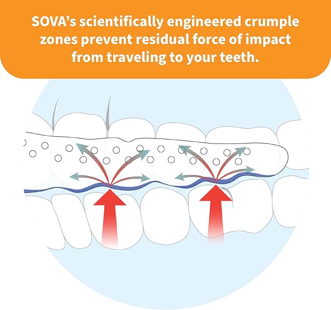SOVA Junior Night Guard, Purple Punch - 1.6mm Thin - Custom-Molded Fit - Protects Against Nighttime Teeth Grinding & Clenching - FSA/HSA Eligible - Odor & Taste Free - Remoldable Up to 20 Times