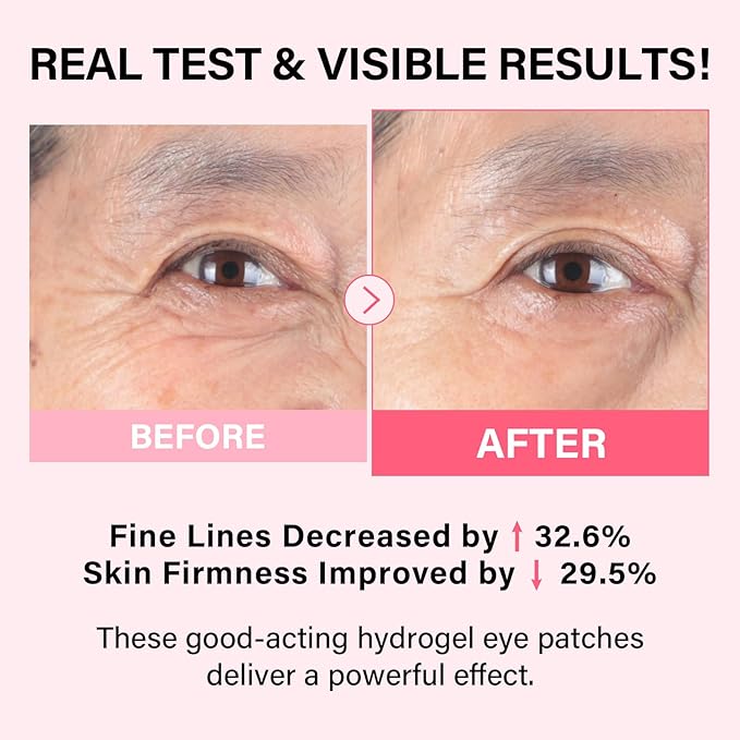 iMethod PDRN Collagen Boost Eye Mask - Under Eye Patches, Instant Lift Under Eye Mask for Reduce Fine Lines & Wrinkles, Firming Eye Patches for Puffy Eyes, Eye Bags, Dark Circles, 8 Pairs