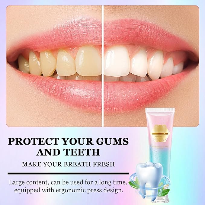 2Pcs Niacinamide Whitening Toothpaste Acssart Radiant White Toothpaste,Niacinamide Intensive Whitening Toothpastes,Nicotinamide Radiant Whiten Toothpastes