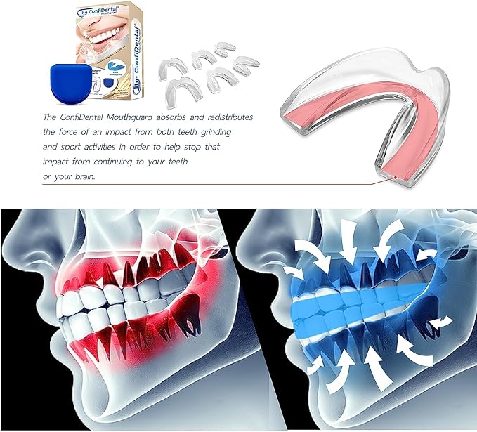 The ConfiDental Mouth Guard for Grinding Teeth at Night - 2 Models for Larger Mouth Pack of 6 Moldable Dental Night Guards for Teeth Grinding and Clenching Teeth Grinding Mouth Guard for Sleep