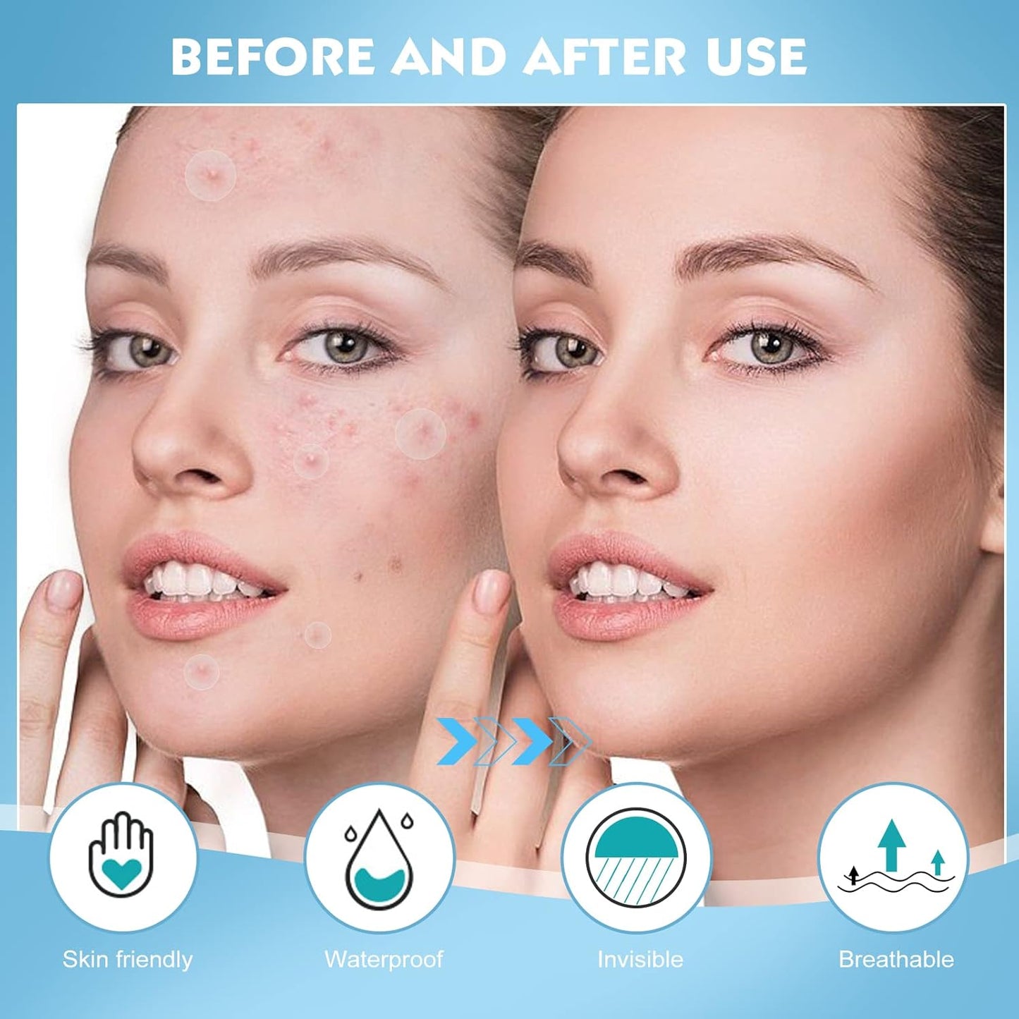 Pimple Patches for Face - 360 Counts Hydrocolloid Acne Patches Salicylic Acid with Tea Tree Oil for Zit Blemish Spot Covers Invisible Hydrocolloid Patches Pimple Acne Stickers