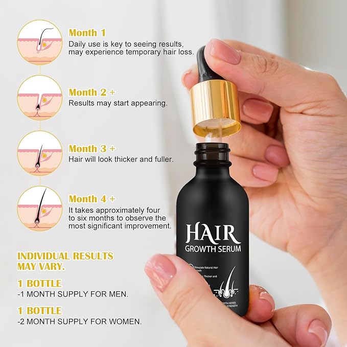 Hair Growth Oil and Derma Roller 0.25mm Scalp Kit, Natural Serum With Biotin, Microneedle Beard Roller for Thicker Longer Fuller Hair and Beard - 2.02 Oz