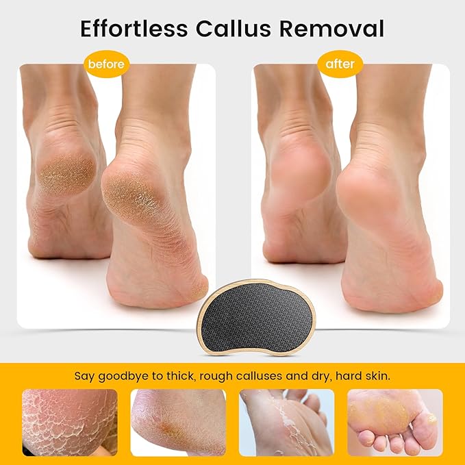 BEZOX Glass Foot Scrubber Shower(1 PCS) - Nano-Glass Pedi Egg Pumice Stone for Feet Dead Skin, Plastic-Free Pedicure Foot File Callus Remover - Bamboo Handle