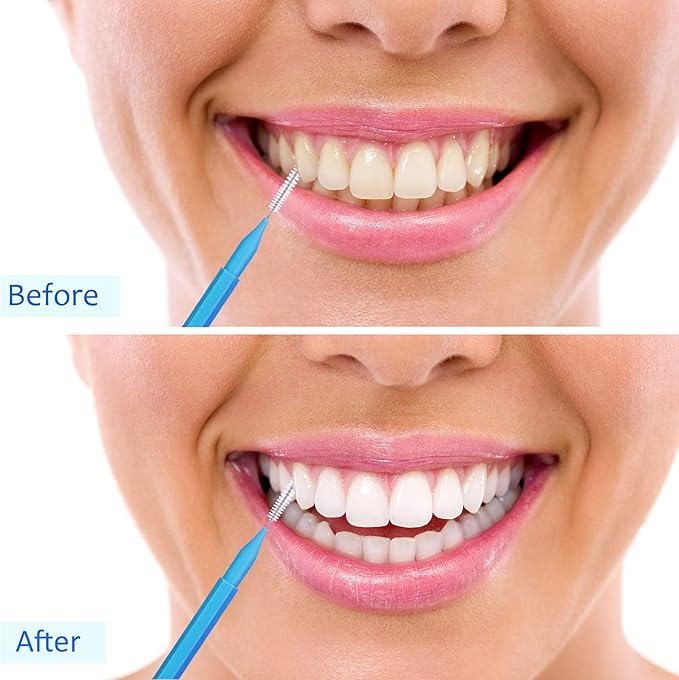 Patelai 100 Pieces Braces Brush for Cleaner Interdental Brush Toothpick Dental Tooth Flossing Head Oral Dental Hygiene Flosser Toothpick Cleaners Tooth Cleaning Tool (Classic Color)