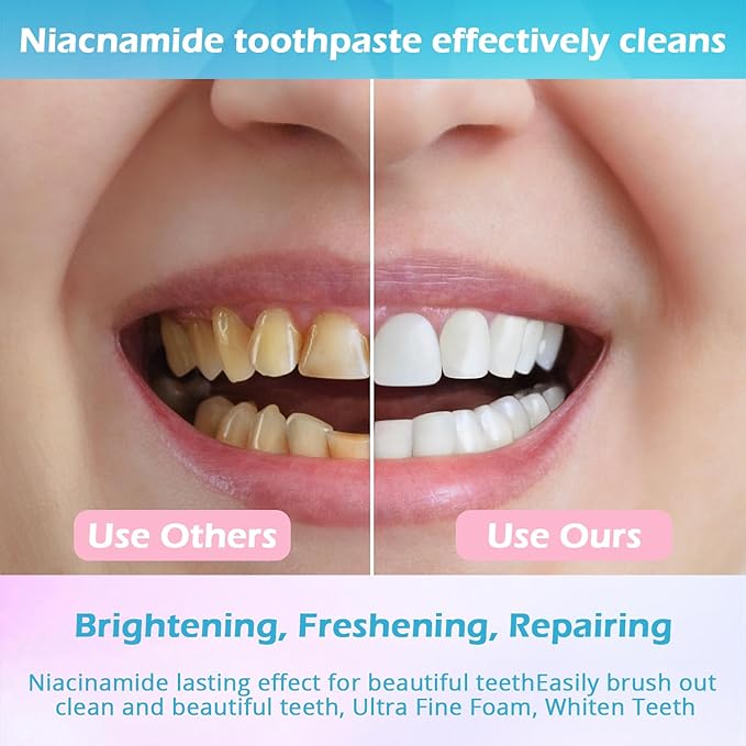 Niacinamide Whitening Toothpaste, Niacinamide Toothpaste Intensive Whitens Teeth, Protects Enamel, Removes Stains & Refreshes Breath, Daily Oral Care at Home Mint Flavor (3 Pack) YanxiananYagao
