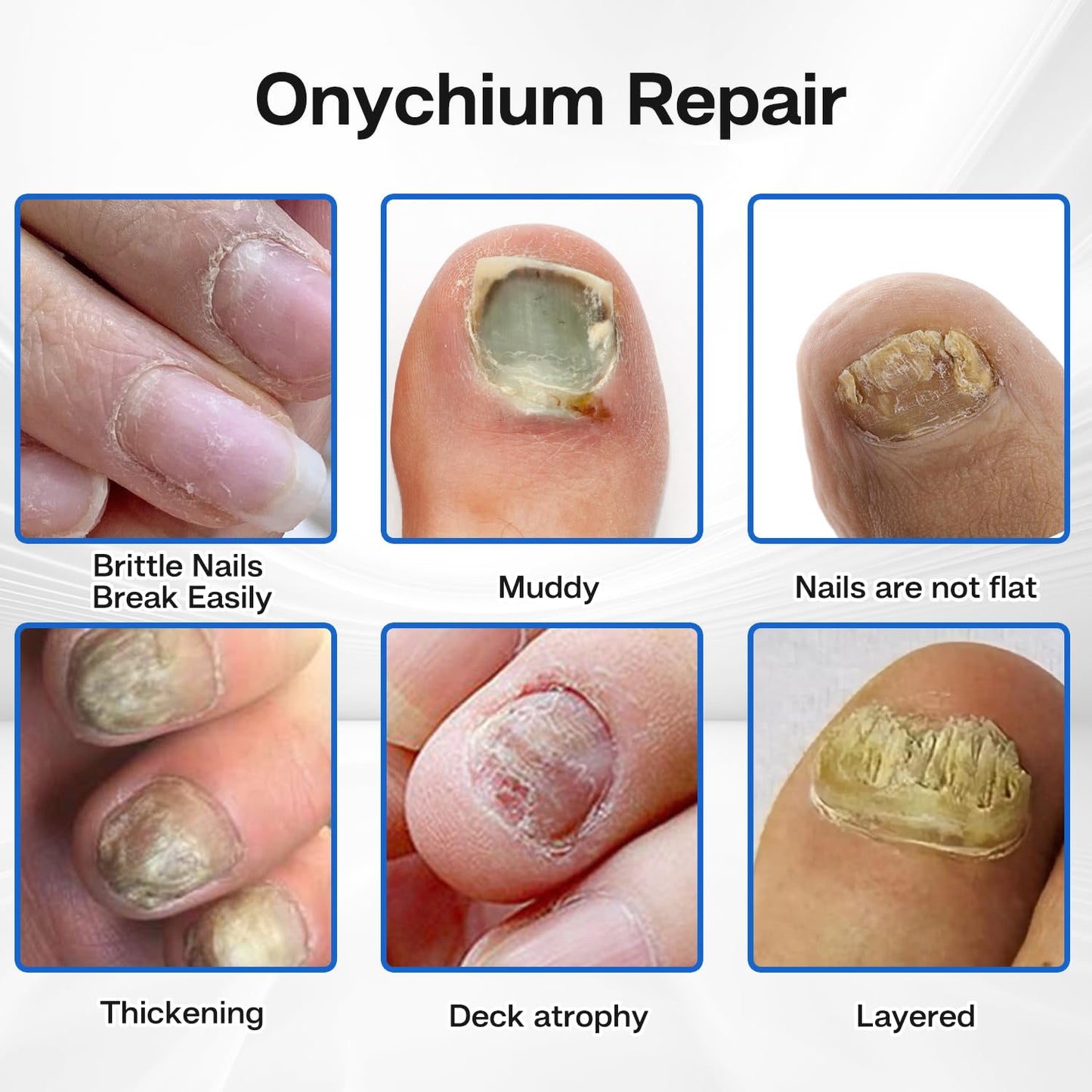 Nail Patches - Toenail Care for Toenail Fingernails - 8-Hour Nightime Nail Renewal - 60