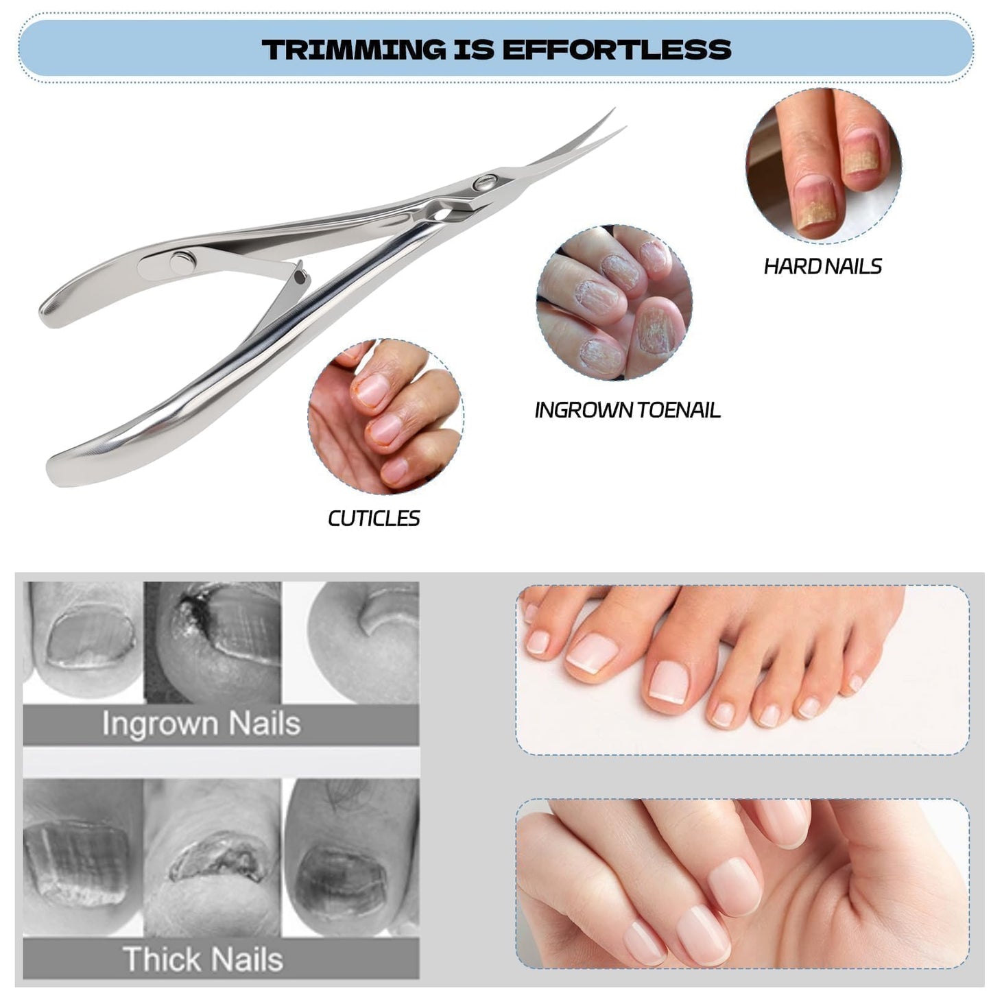 Criyar Professional Surgical Grade Cuticle Nippers - High Heat Treated Stainless Steel Cuticle Trimmer with Double Spring - Ultra Sharp Dead Skin Remover Scissors for Manicure & Pedicure (Silver)