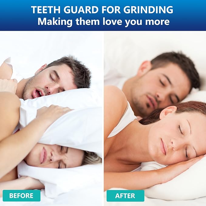 Mouth Night Guards for Teeth Grinding, Mouthguards for Grinding of Teeth, Mouth Guard for Clenching Teeth at Night with 12 Cleaning Tablets