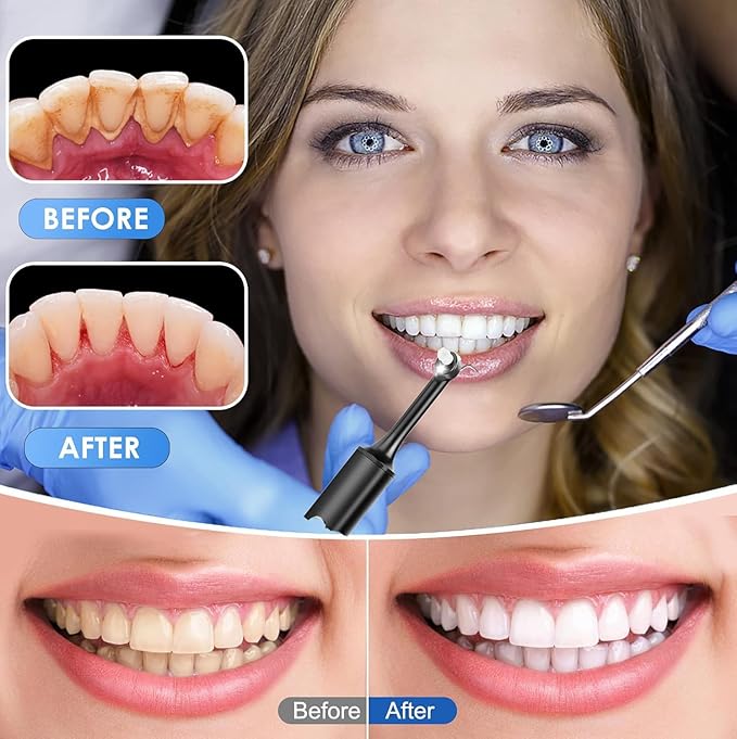 Tooth Polisher,Teeth whitening kit 12 Pieces Accessories，Teeth Polishing Kit for Daily Cleaning,Polishing Then Whitening kit
