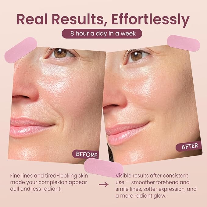 Anti-Wrinkle Patches, BEGOODSKIN, Face Lift Tape, Smile Line, Forehead& Under Eyes Wrinkle Patches, Wrinkle-Reducing for Skin, Overnight Smoothing& Tightening, Wrinkle Treament Remover, 128Patches