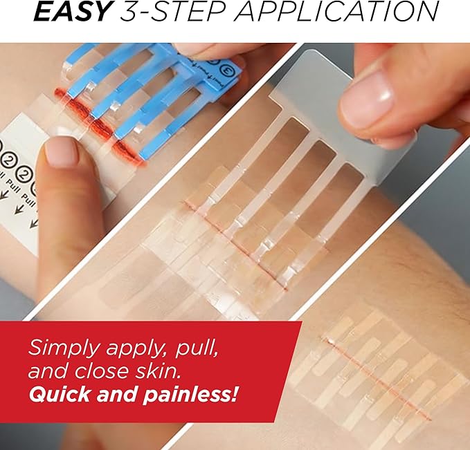 Clozex Emergency Laceration Closures - Repair Wounds Without Stitches, FSA HSA Eligible Skin Closure Device for 2 Individual Wounds Or Combine for Total Length of 2 Inches