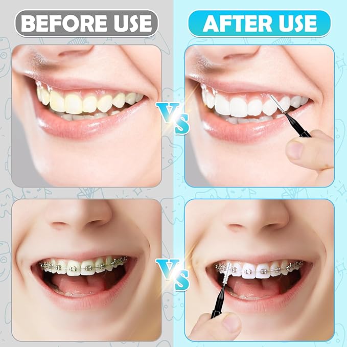 120 Pieces Interdental Brushes, Braces Brush Cleaner Orthodontic Flossers Toothpicks Floss Picks for Braces Kit for Teeth Cleaning Tools Spiral Dental Brush Head for Efficient Oral Care Black