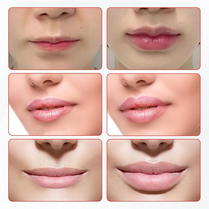 Lip Plumper Device for Fuller Lips - 1pc Cute Fish Mouth Shaped Silicone Lip Plumping Tool Sexy Lip Mouth