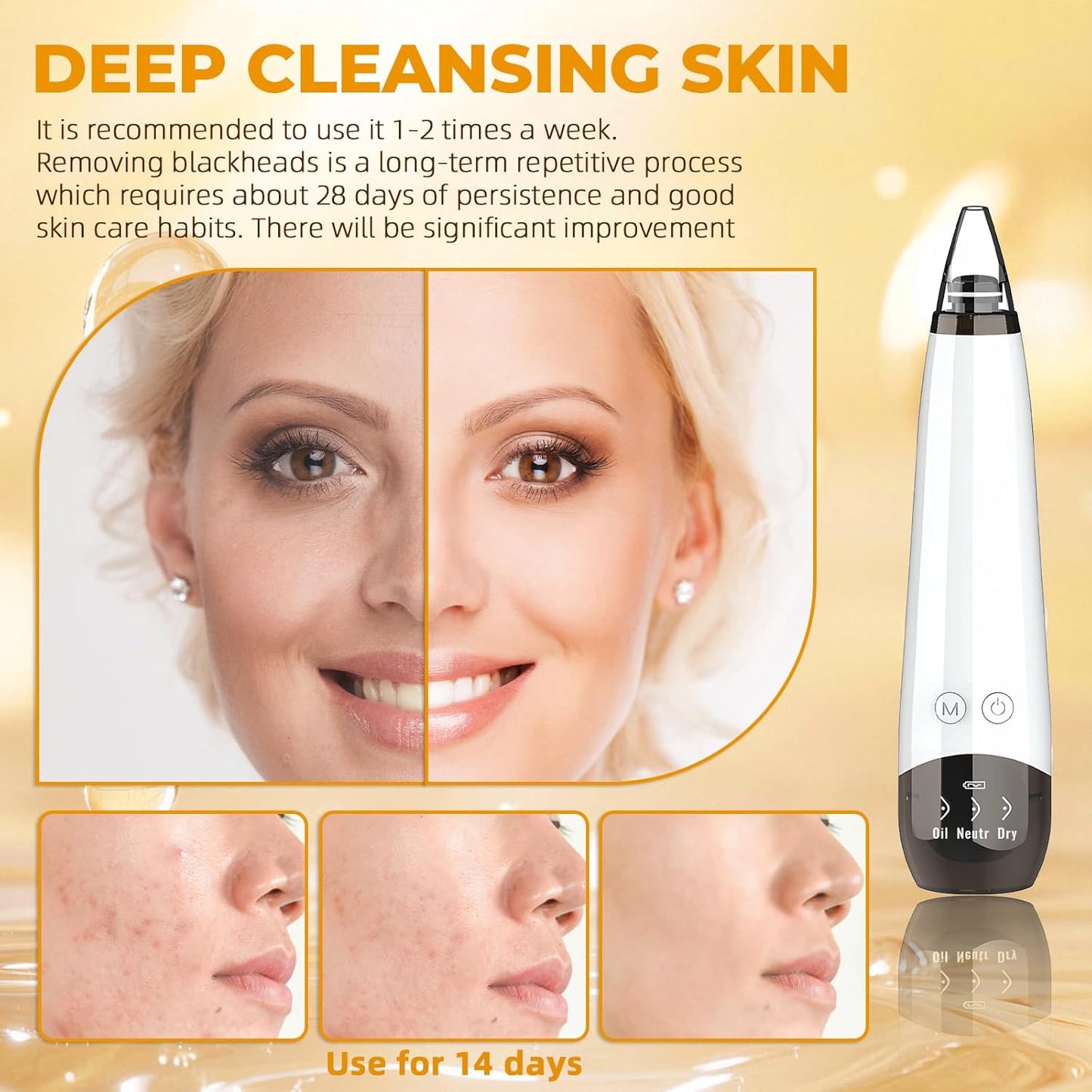 Pore Vacuum, USB Rechargeable Blackhead Remover Vacuum,3 Levels Adjustable Pore Vacuum Blackhead Remover, with 6 Suction Power Probe,4 Golden Needle,Face Vacuum Pore Cleanser for Women & Men-White