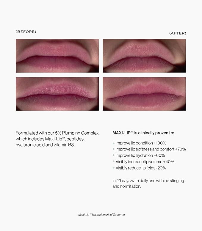 MAKE Beauty Inner Tube Lip Plumper Balm - 5% Plumping-Complex Peptide Lip Treatment with Hyaluronic Acid for Amplified Plumping. Hydrating Filler Effect for Fine Lines and Fuller Pout